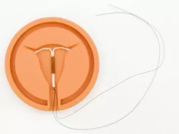 A hormone spiral, T-shaped piece of plastic placed inside the uterus. The piece of plastic contains copper or a synthetic progesterone hormone that prevents pregnancy. (Photo: iStockphoto)