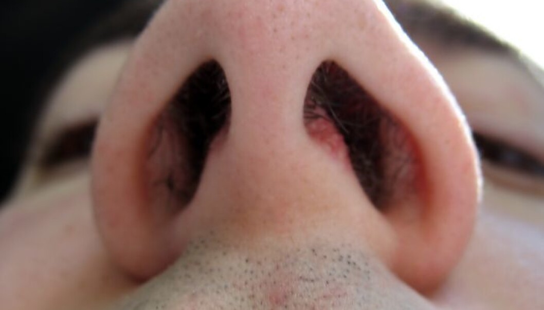 The nose signal power or lack of power. The nose signal power or lack of power.
