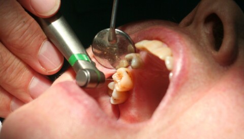 Why don't teeth heal themselves? Why don't teeth heal themselves?