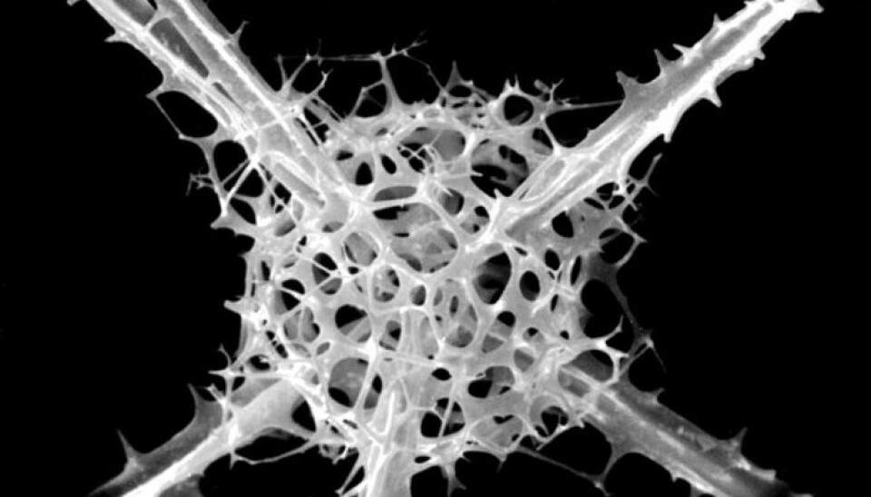 Rhizoplegma boreale, fossil Radiolarian from Holocen. (Photo: Jane K. Dolven, University of Oslo)