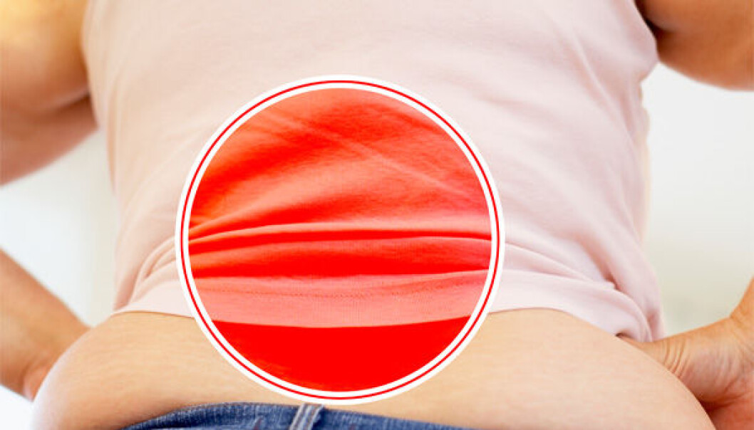 Heavy women are hardest hit by back pain. (Photo: Colourbox / Per Byhring) Heavy women are hardest hit by back pain. (Photo: Colourbox / Per Byhring)