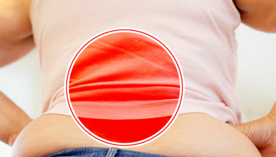 Heavy women are hardest hit by back pain. (Photo: Colourbox / Per Byhring)