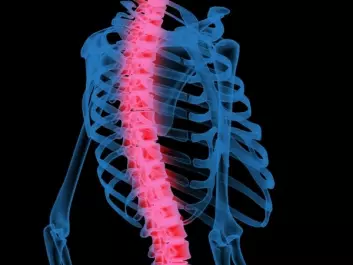 Overweight can put a mechanical load on the spine. (Photo: Colourbox)