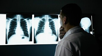 High levels of vitamin B12 can increase lung cancer risk