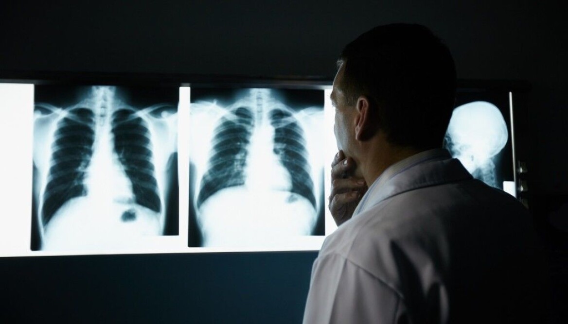 (Foto: Diego Cervo / Shutterstock / NTB scanpix) (Foto: Diego Cervo / Shutterstock / NTB scanpix)