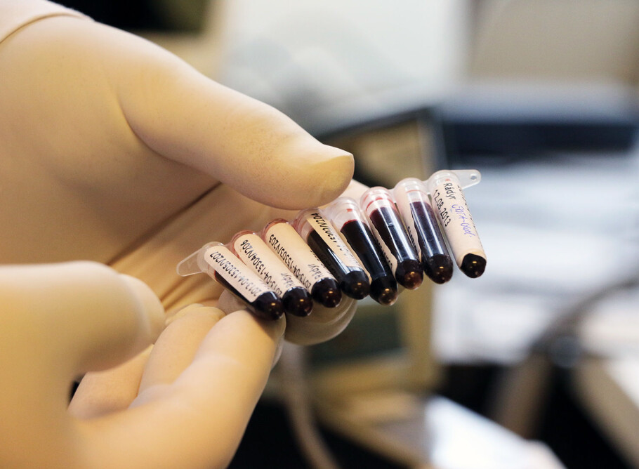 Samples of blood from cervids. (Photo: Mari M. Press)