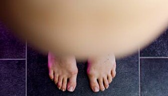 PCOS occurs in 10 to 15 per cent of all women. (Photo: Colourbox) PCOS occurs in 10 to 15 per cent of all women. (Photo: Colourbox)