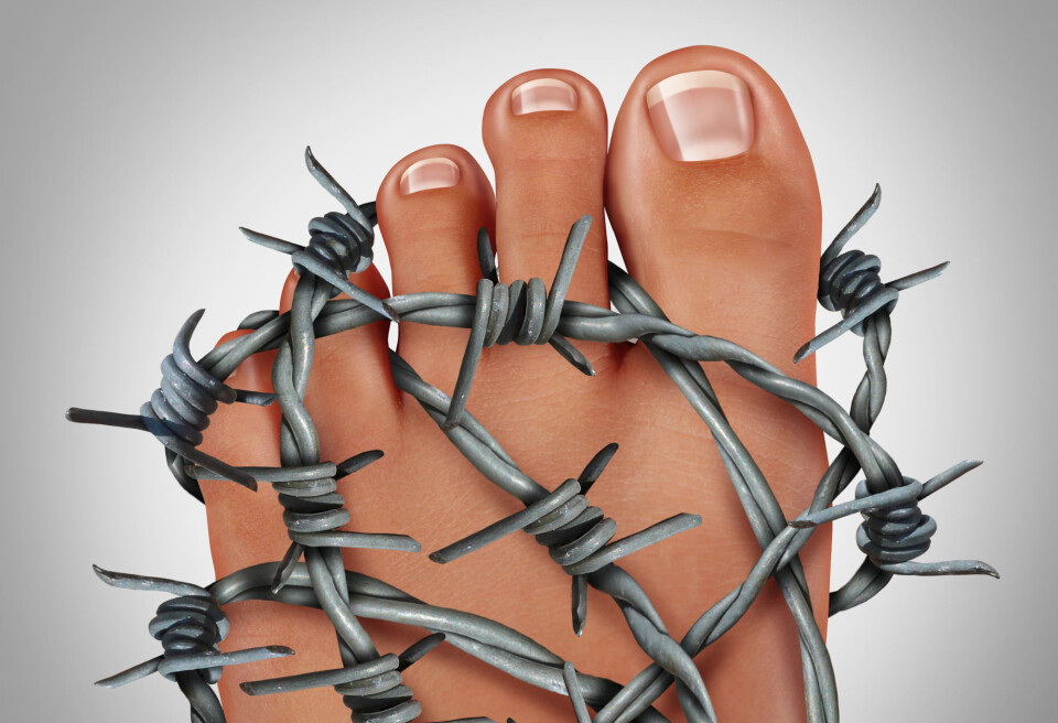 Symptoms of a gout attack are typically manifested in the big toe. It causes extremely painful joints. (Photo: Colourbox)