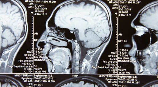 Breathing can affect the cleansing of the brain Breathing can affect the cleansing of the brain