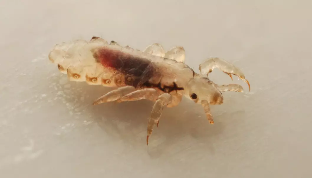 Head lice only live on humans. They suck our blood and have to live close to our scalps. (Photo: devil79sd / Shutterstock / NTB scanpix)