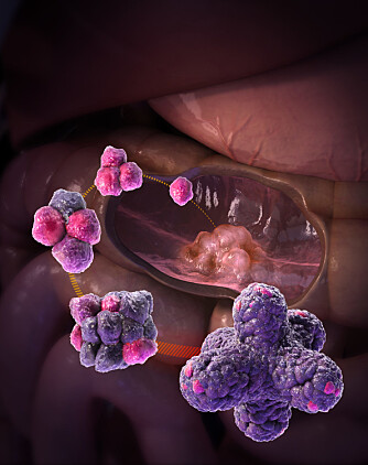 Artist’s view of the process of growing organoids from adult intestinal stem cells. (Illustration: Courtesy Hans Clevers) Artist’s view of the process of growing organoids from adult intestinal stem cells. (Illustration: Courtesy Hans Clevers)