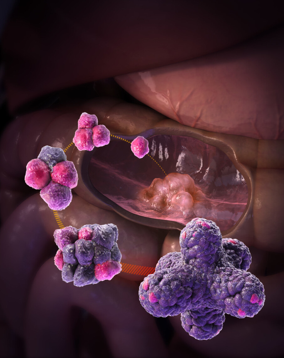 Artist’s view of the process of growing organoids from adult intestinal stem cells. (Illustration: Courtesy Hans Clevers)