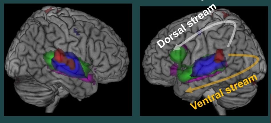 Language perception and brain networks (Photo: UiB)