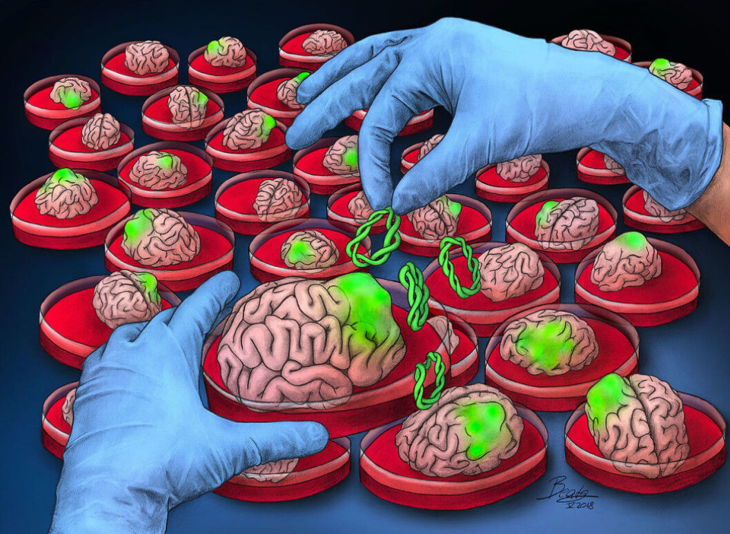 By growing small brains in the lab, researchers can test out new treatments for brain diseases. Here is an artist's interpretation of growing brain cancer in a dish. In reality, today's cultured mini-brains are far smaller, just a few millimetres, and they look different. By growing small brains in the lab, researchers can test out new treatments for brain diseases. Here is an artist's interpretation of growing brain cancer in a dish. In reality, today's cultured mini-brains are far smaller, just a few millimetres, and they look different.