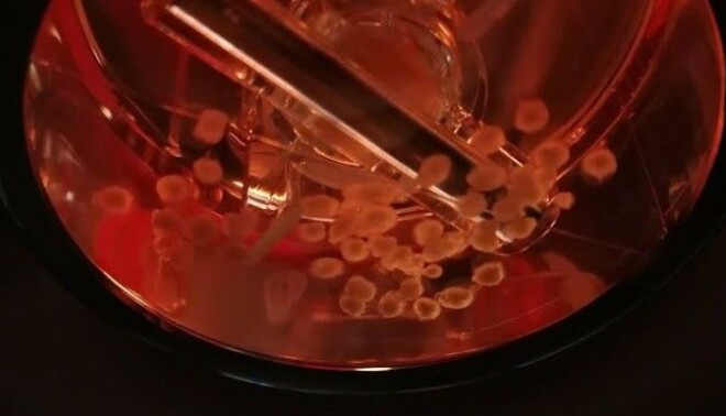 In this picture, taken on an earlier occasion, we see mini-brains being cultivated at St. Olav's hospital. The small blobs float in a container with a pink medium that is slowly stirred. In this picture, taken on an earlier occasion, we see mini-brains being cultivated at St. Olav's hospital. The small blobs float in a container with a pink medium that is slowly stirred.