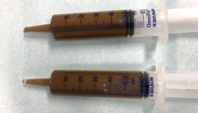 The researchers used stools from the same donor, but in different doses. The researchers used stools from the same donor, but in different doses.