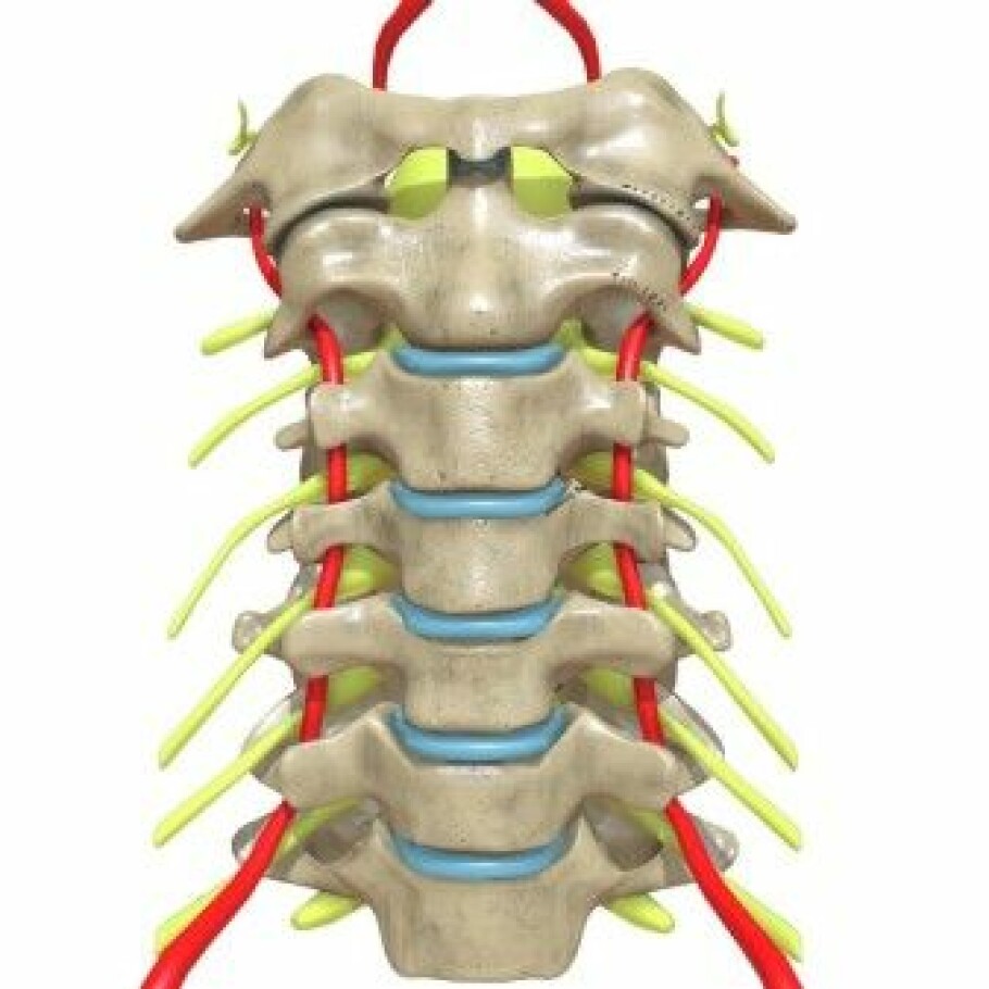 An illustration of what the human neck looks like. The red lines are blood vessels, and the yellow ones are nerves from the vertebrae.