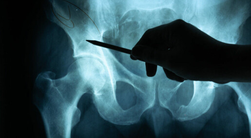 Greater risk of dying from a hip fracture if you live in the city