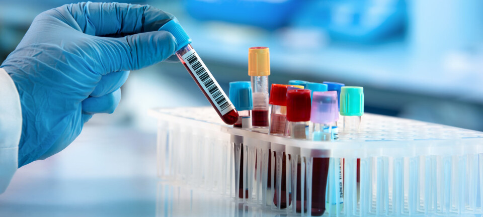 Proteins in blood test can reveal and predict disease