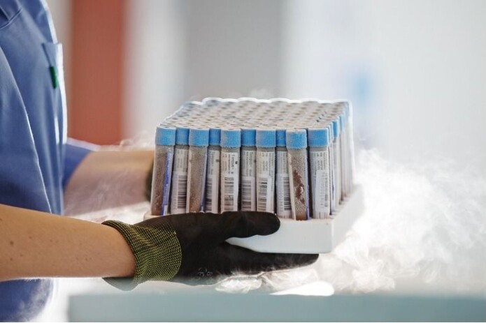 Blood samples from HUNT were used in the study that shows that proteins in the blood can reveal disease and risk of disease. Blood samples from HUNT were used in the study that shows that proteins in the blood can reveal disease and risk of disease.