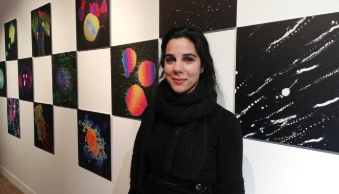 Irep Gözen displays colourful microscopy images. Irep Gözen displays colourful microscopy images.