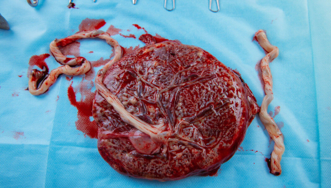 The placenta is examined after birth to see if it is intact. How the placenta grows can give a clue as to the conditions the foetus experienced in the uterus. The placenta is examined after birth to see if it is intact. How the placenta grows can give a clue as to the conditions the foetus experienced in the uterus.