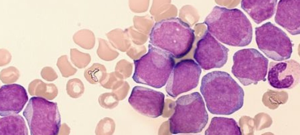 Working hard to find therapy approaches designed to fit your cancer