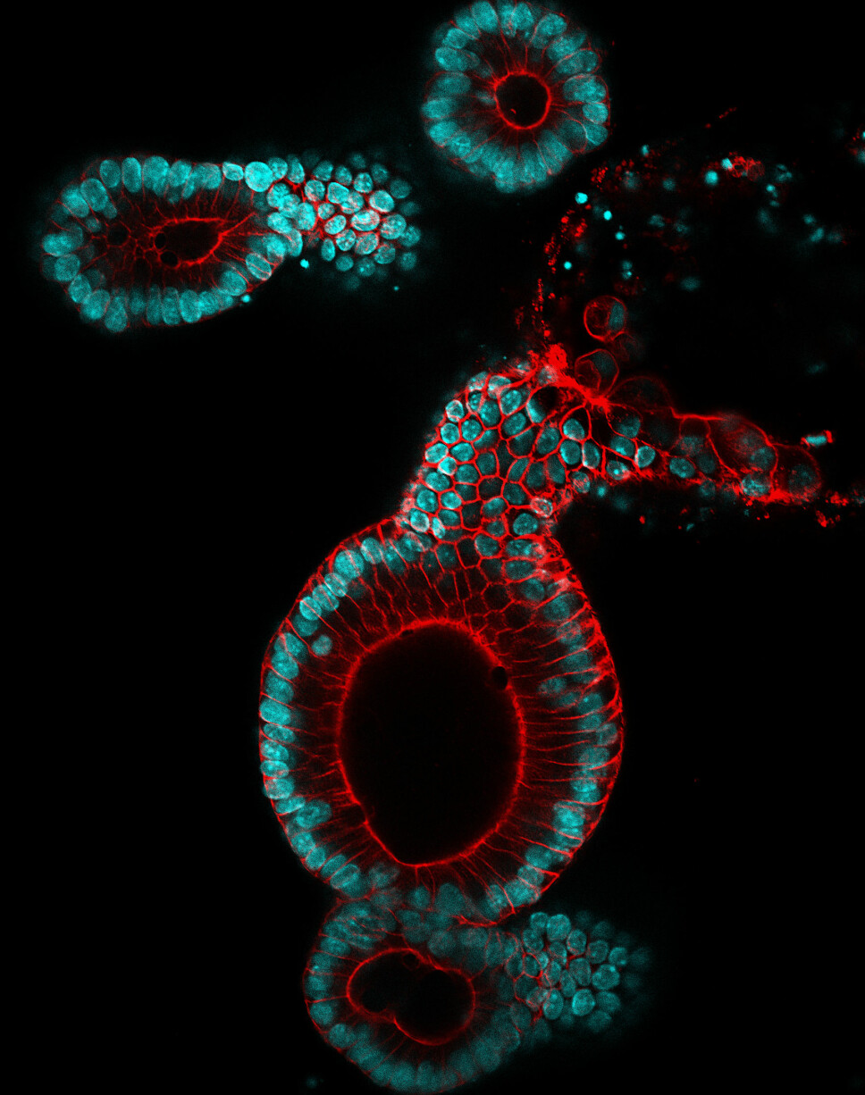 Organoids grown from a mouse’s colon will be used to screen drugs for colorectal cancer. These structures appear as a dot to the naked eye, and need specialised microscopes for analysis. Scale bar is 50 μm.