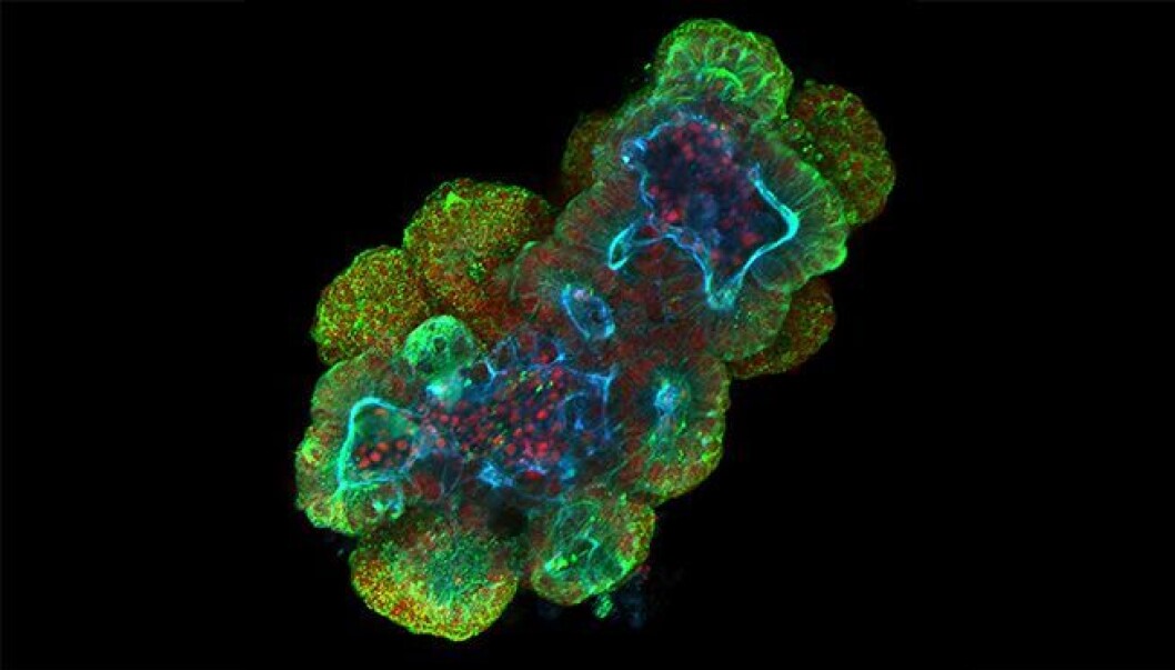 Beautiful science: Small intestinal organoid from mouse. Scale bar, 20µm. Beautiful science: Small intestinal organoid from mouse. Scale bar, 20µm.