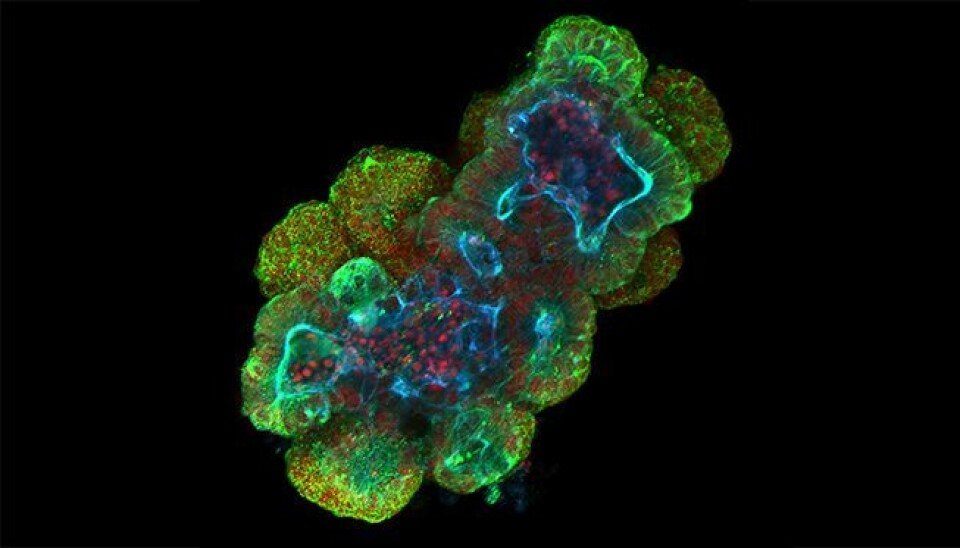 Beautiful science: Small intestinal organoid from mouse. Scale bar, 20µm.