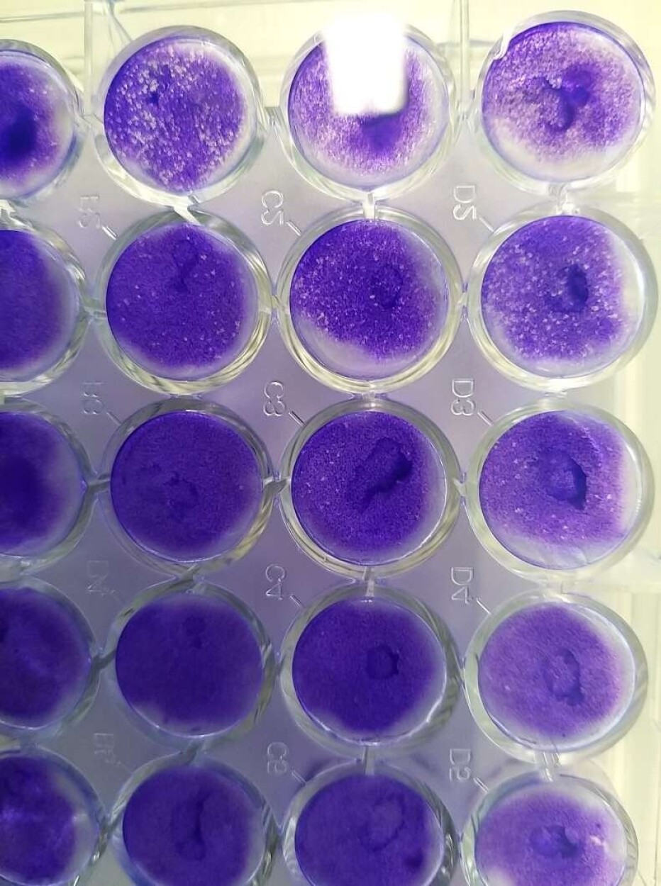 Here’s what the cell cultures look like during the tests.