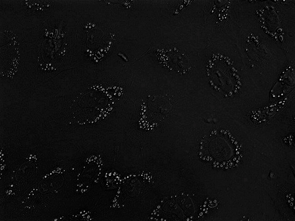 In this salmon fat cell (in principle similar to a human cell), the stores of fat are seen as small droplets inside the cell.