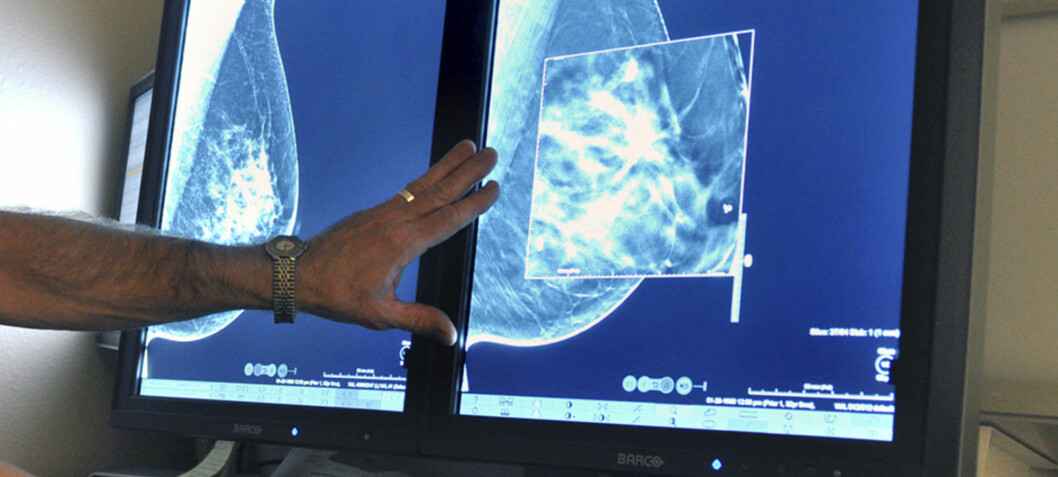 Norwegian researchers are developing a new method for detecting breast cancer