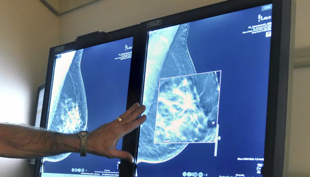 It can be demanding for a radiologist to interpret some mammograms. Artificial intelligence can help them in the future.