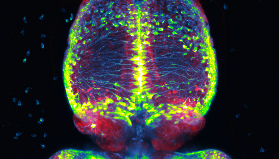 The picture shows parts of a zebrafish brain, including a part called the habenula. The green dots are parent cells, which can divide into new brain cells. Zebrafish brains have a lot of these cells, a feature that gives these animals a great ability to repair damage to the brain.