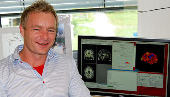 Anders Fjell and his colleagues at the University of Oslo are working with data from thousands of participants. These large studies show that there are very modest associations between quality of sleep and brain health. Anders Fjell and his colleagues at the University of Oslo are working with data from thousands of participants. These large studies show that there are very modest associations between quality of sleep and brain health.