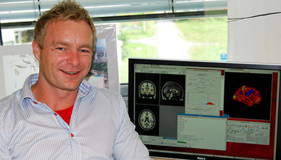 Anders Fjell and his colleagues at the University of Oslo are working with data from thousands of participants. These large studies show that there are very modest associations between quality of sleep and brain health.