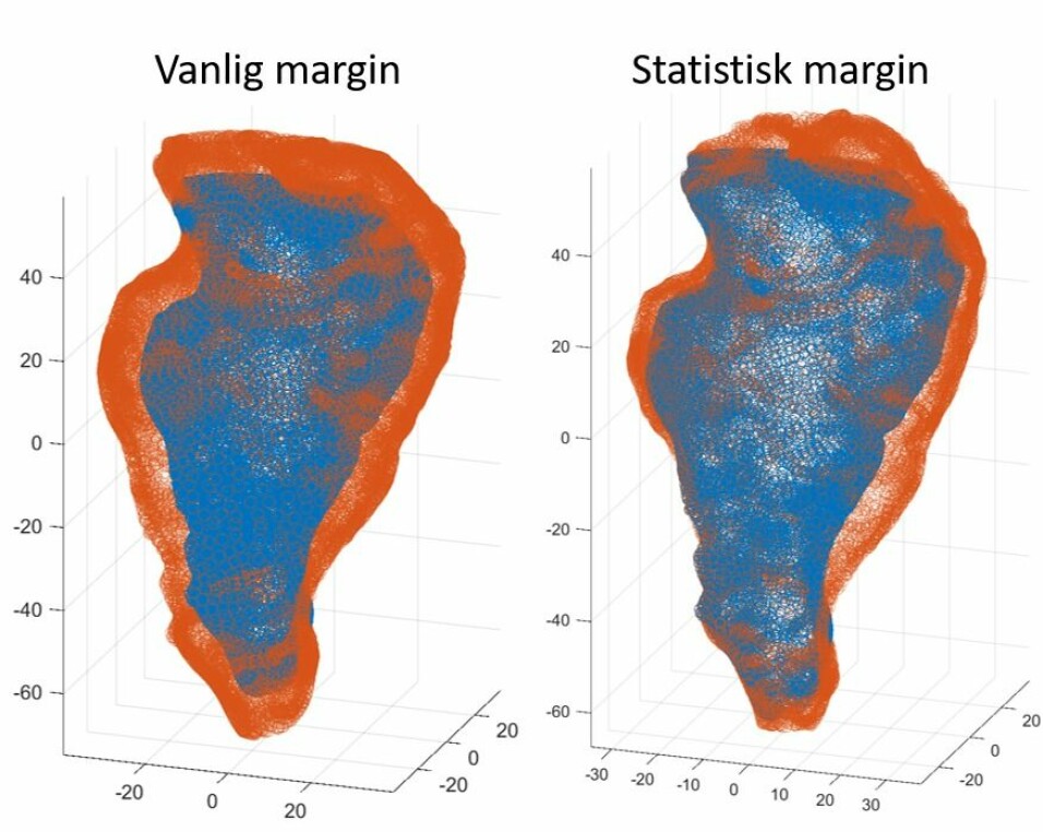 This is how researchers can protect healthier tissue in the rectum: The orange area in the left image is the extra tissue that is now irradiated outside the tumour as a safety margin. The orange area in the picture to the right is 20 per cent smaller, and is based on the new statistical calculations.