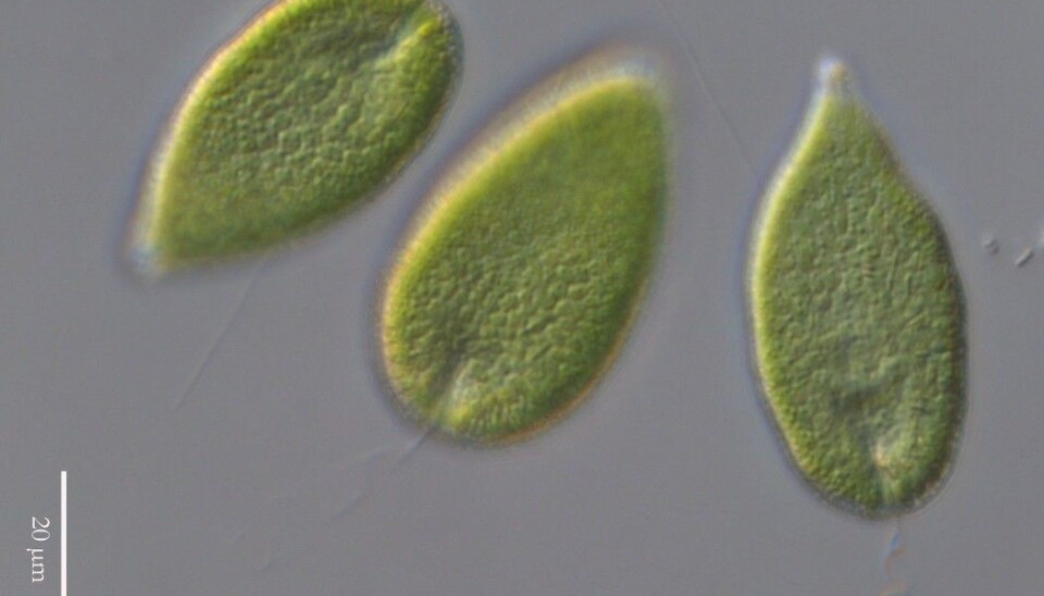 The algae Gonyostomum semen under a microscope.