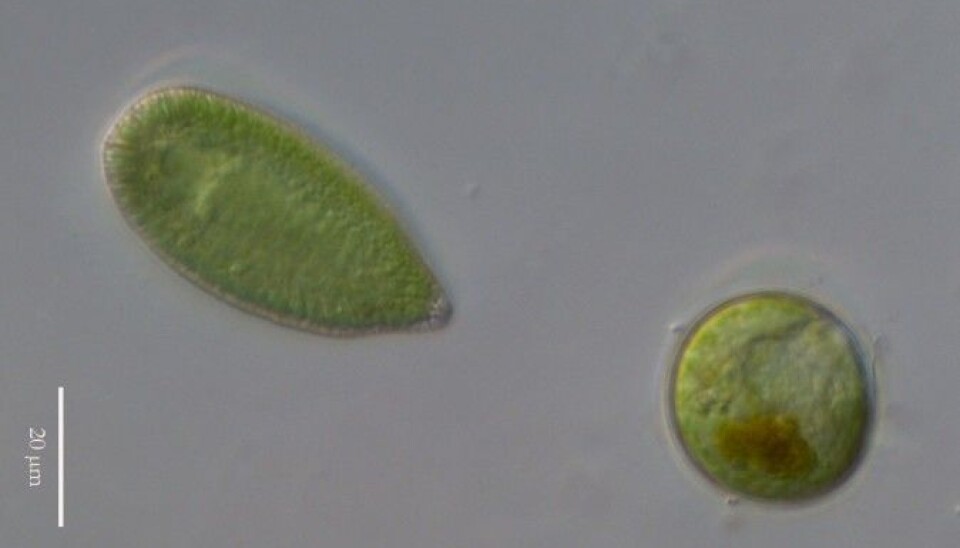 The algae Gonyostomum semen under a microscope.