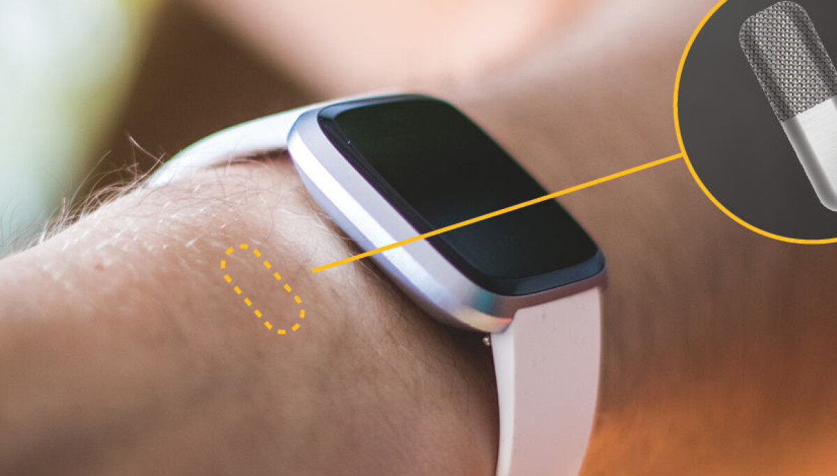 This tiny sensor placed under the skin will measure the blood sugar ...