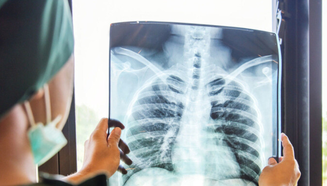 Among Norwegian women who get lung cancer, one in four survives for five years. In Finland, it is only one in five. For men, survival is lower. Among Norwegian women who get lung cancer, one in four survives for five years. In Finland, it is only one in five. For men, survival is lower.