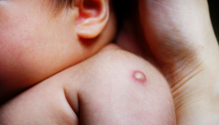Can a prick in the arm actually protect against more diseases than tuberculosis? Numerous studies indicate just that. Can a prick in the arm actually protect against more diseases than tuberculosis? Numerous studies indicate just that.