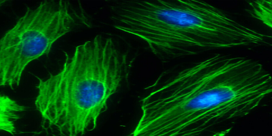 The picture shows heart cells formed by stem cells. The cell nucleus appears blue and stem cells are green. NTNU researchers have identified a protein that heart-diseased rats are deficit in, but which increases when the rats have been on an exercise regimen.