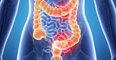 Promising results for colon cancer screening