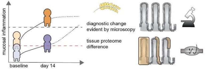 Proteomic analysis of coeliac patient intestinal tissue reveals certain people display low level inflammation that gives them a 'head start' when exposed to gluten (see chart to left of image). After 14 days their mucosal inflammation is therefore more severe (orange figure) than those without baseline inflammation (purple figure). The low level inflammation revealed by proteomics is not detected by the standard diagnostic approach of visualizing biopsies by microscopy.