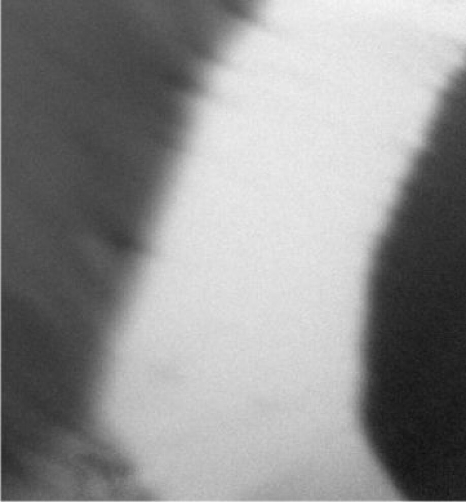 The white and dark regions represent different magnetic regions, having their ‘compass needle’ pointing in different directions. The present study shows how to engineer materials with only one magnetic ordering. Data taken in collaboration with Ingrid Hallsteinsen, Rajesh Chopdekar (SLS), Erik Folven and Jostein Grepstad.