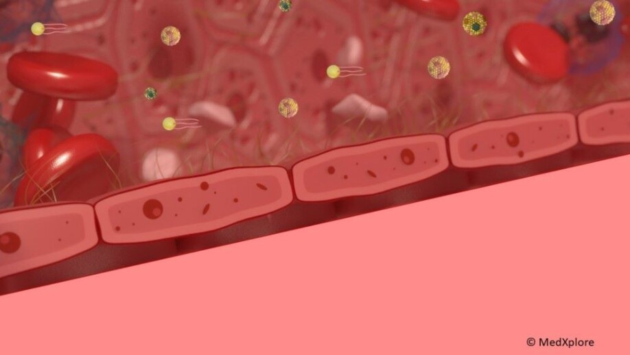 Illustration of blood vessels with lipids. The image was developed by MedXplore and is used for teching purposes.