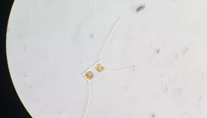 A lonely algae, <span class="italic" data-lab-italic_desktop="italic">Chaetoceros decipiens</span>, which with its two clear spores shows me that spring is not a reality at 82 degrees north right now. How much longer do they have to wait though?