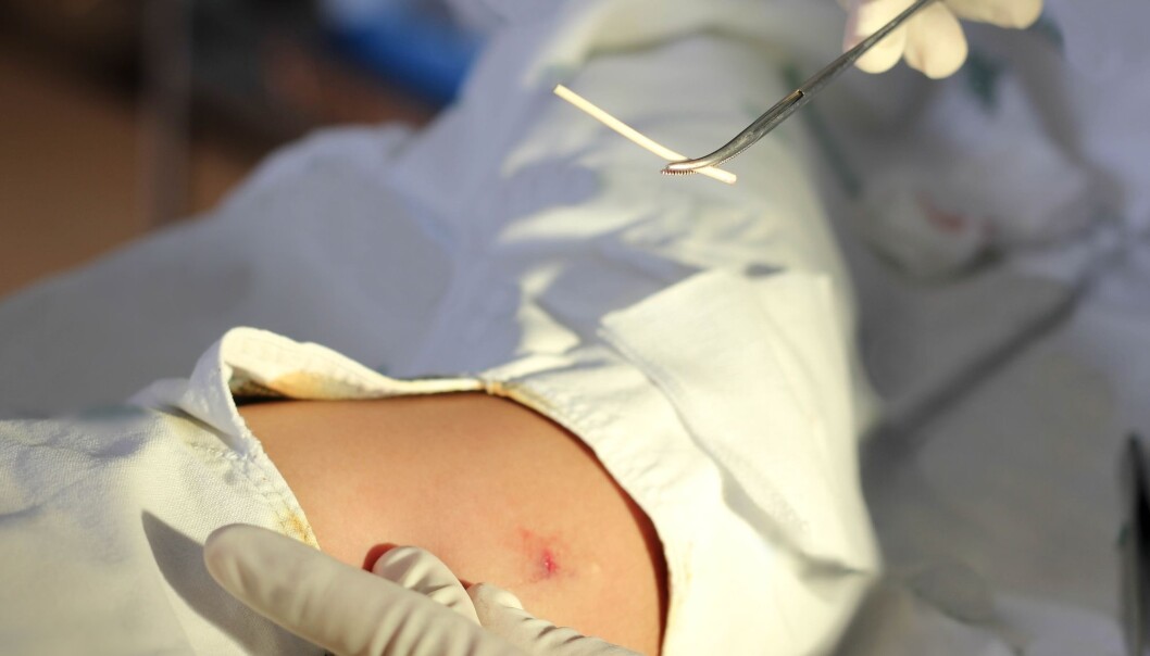 Healthcare professionals must be careful when inserting birth control implants. If the contraceptive implant is difficult to locate by feel, they need to bring in a surgeon who has expertise in working close to nerves and blood vessels, four surgeons write in a new article. Healthcare professionals must be careful when inserting birth control implants. If the contraceptive implant is difficult to locate by feel, they need to bring in a surgeon who has expertise in working close to nerves and blood vessels, four surgeons write in a new article.